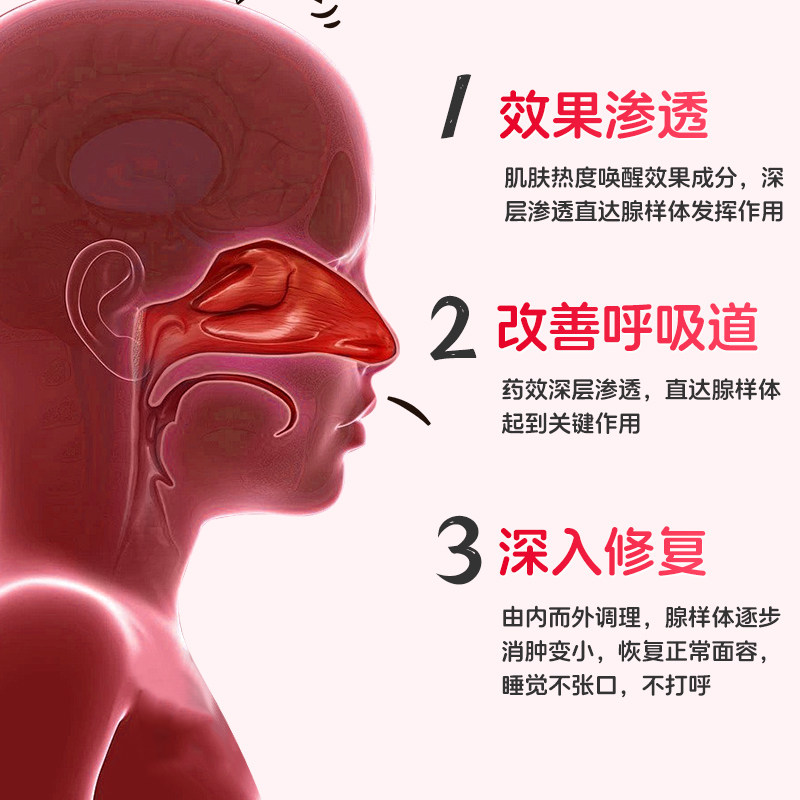 葵花儿童腺样体肥大贴面容扁桃体肿大矫正器中药贴睡觉打呼噜调理