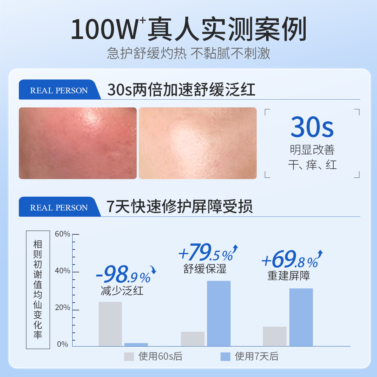 医用乳液面霜敏感肌修复脸部泛红皮肤屏障肌肤受损修护水乳护肤品