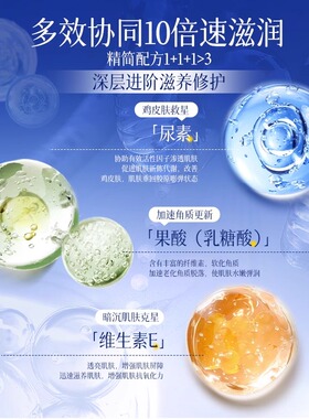 果酸ve尿素霜去鸡皮疙瘩毛囊角质补水保湿滋润身体乳维生素e乳膏
