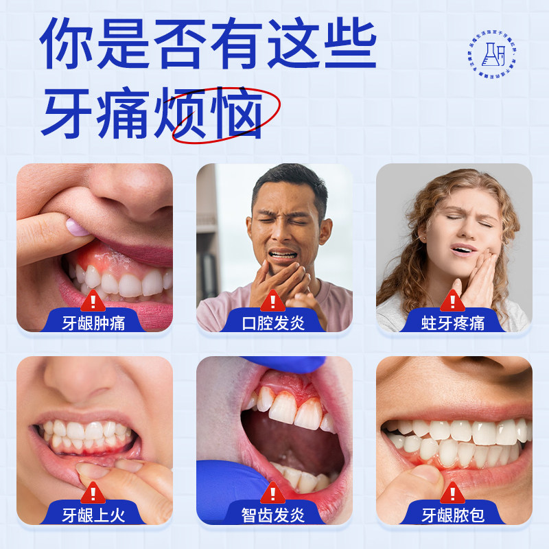 岩井牙疼牙痛专用非药水消炎牙龈肿痛止疼喷雾智齿蛀牙虫牙脓包