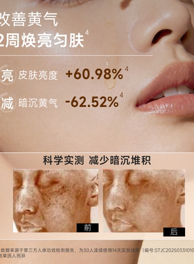 传明酸6%氨甲环酸精华液改善暗黄