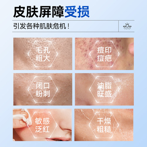 医用冷敷贴械准字号医美修复补水去痘淡化痘印收缩毛孔非面膜型 - 图0