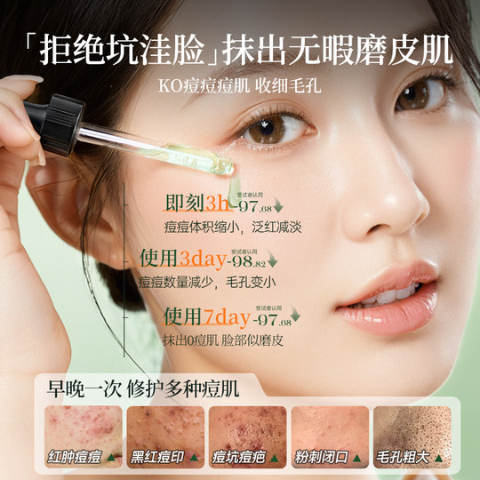 Medizinische Qualität, 3 Tage ohne Akneflecken + 5 % Centella Asiatica-Reparatur