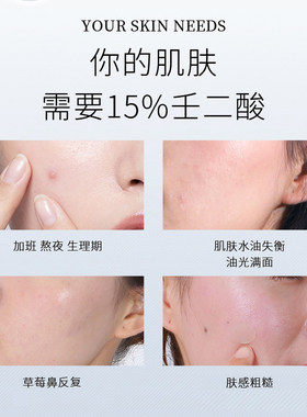 可孚15壬二酸凝祛痘凝胶