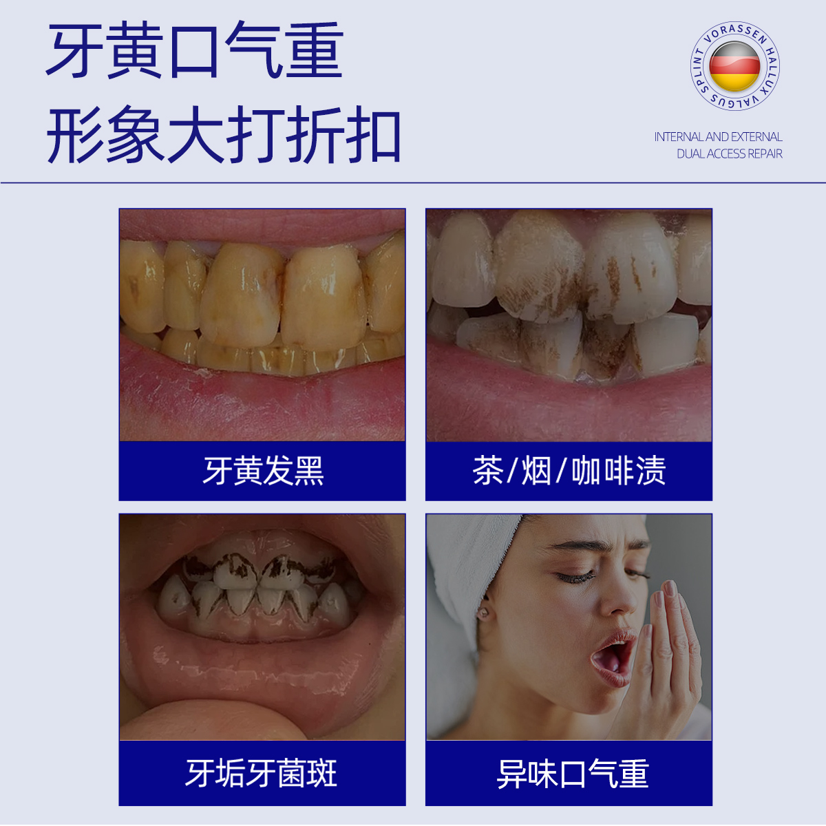 医用去牙结石非牙膏去黄口臭美白专用溶解牙菌斑牙渍牙垢黄牙速效