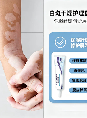 白癜风特药效膏消白斑外用黑色素生长遮盖液神器脸部手部消白软膏