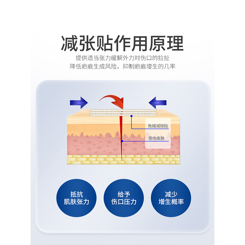 医用皮肤减张贴免缝胶带剖腹产防止增生疤痕贴愈合伤口免缝合器 - 图0