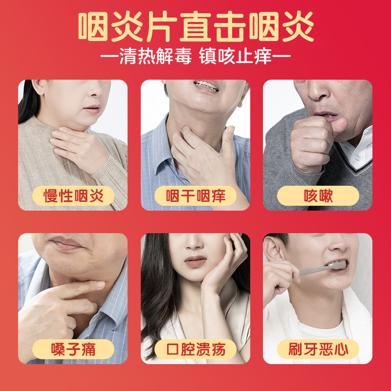 慢严舒柠咽炎片片片利咽发炎咳嗽咽喉炎喉咙嗓子疼急慢性肿痛清咽