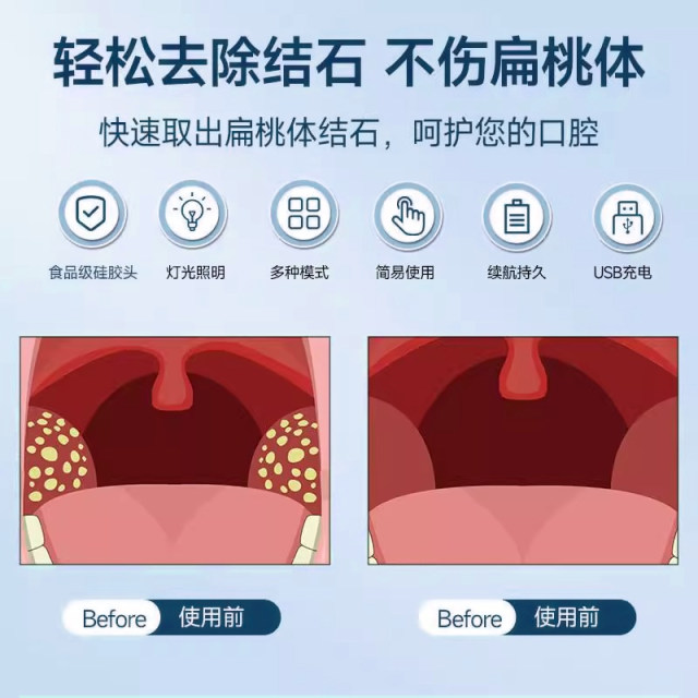 Tonsil stone cleaner