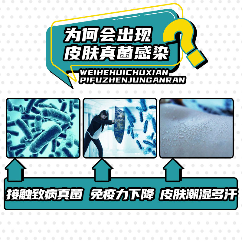 治脚气脚痒止痒膏脱皮杀菌烂脚丫去专用药根真菌感染水泡型非特效 - 图2