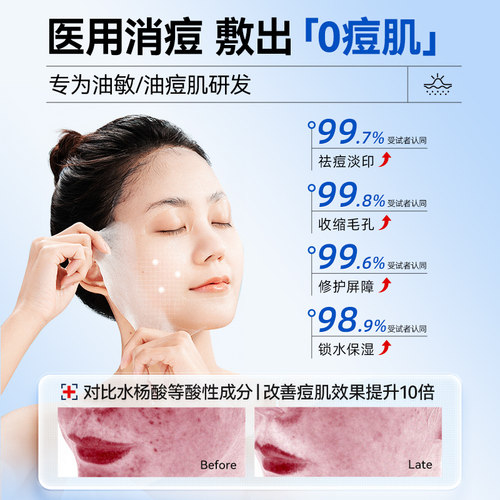 医用冷敷贴械准字号医美修复补水去痘淡化痘印收缩毛孔非面膜型 - 图2