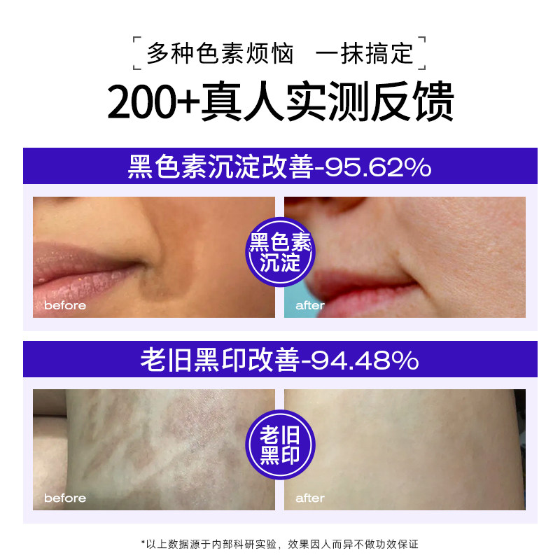 德国去除痘印黑印去疤印脸部淡化沉着修复皮肤祛疤痕膏三型人源化