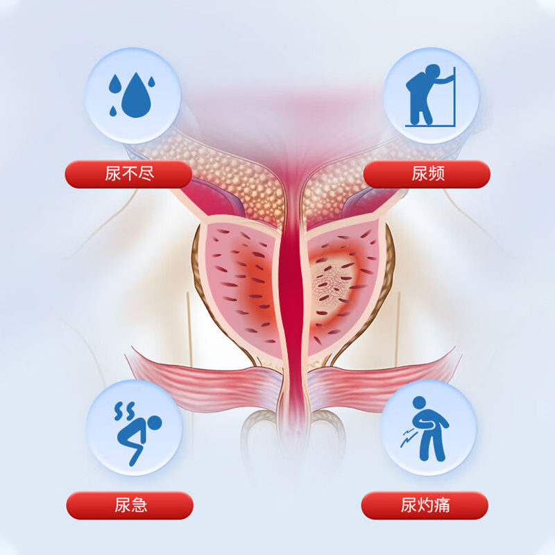 葵花前列腺热敷贴保健贴肚脐穴位贴敷克星男士消炎保养药房同款 - 图0