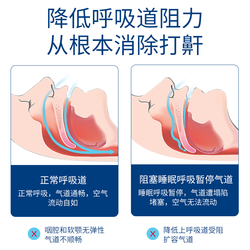 科来雅液体止鼾器止鼾打呼噜防呼噜消男士女轻声防打鼾软化咽部 - 图0