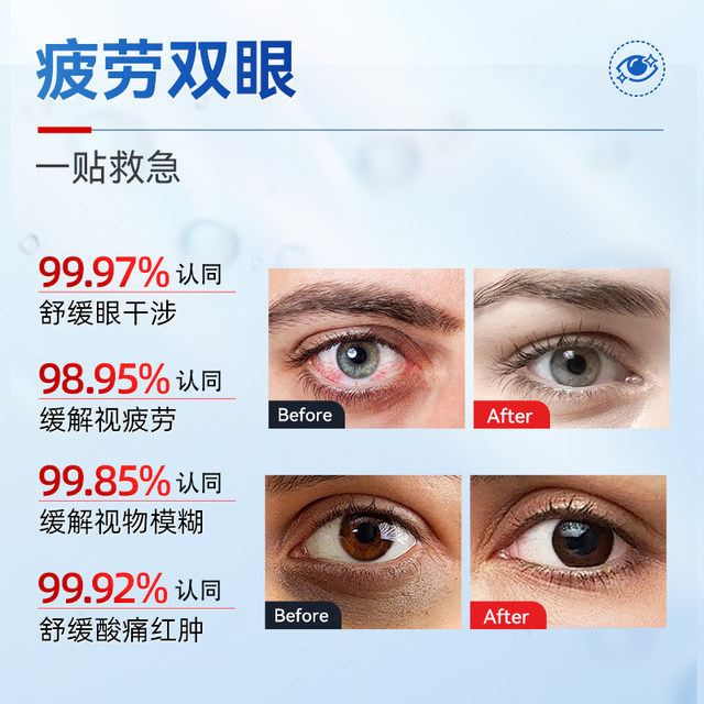 Ice eye patch relieves fatigue around the eyes. Lutein cold compress patch makes the eyes tense and comfortable. Genuine official flagship store