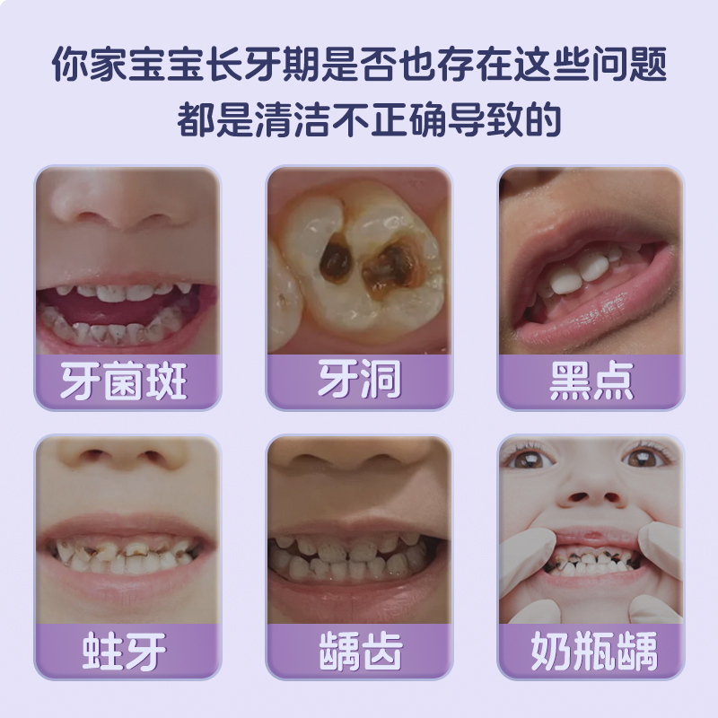 仁和儿童奥拉氟牙膏3到6岁专用防蛀牙修复龋齿含低氟小学生换牙期