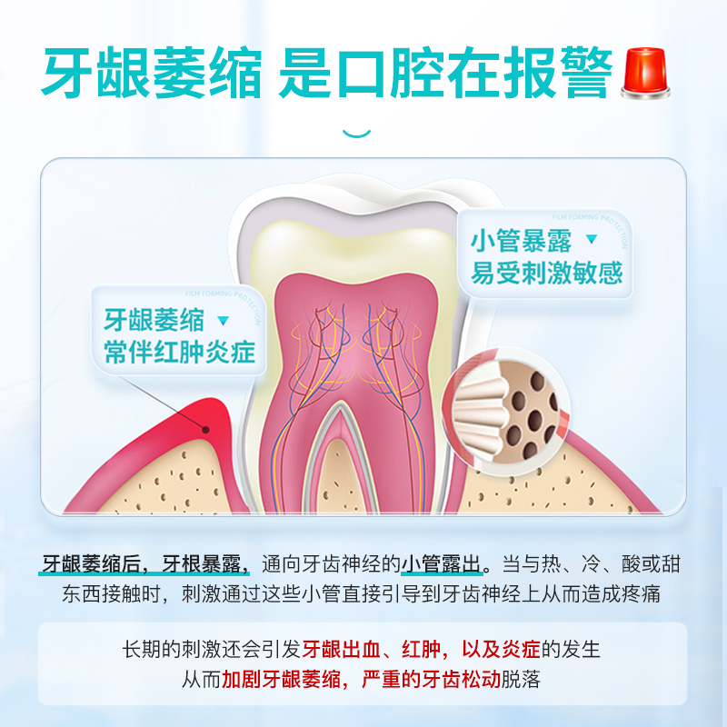 医用牙龈萎缩修复再生专用牙膏治牙周炎口腔护理抗敏感出血红肿痛