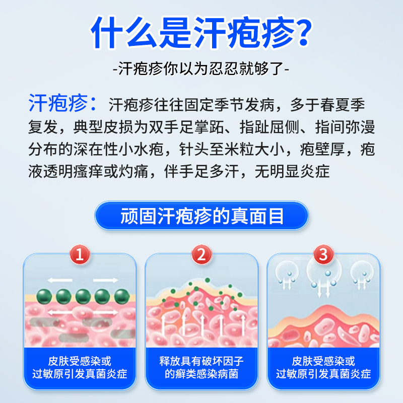 日本汗孢疹手上起小水泡手气止痒脱皮杀菌汗状疱疹专用软膏泡疹珍-图1