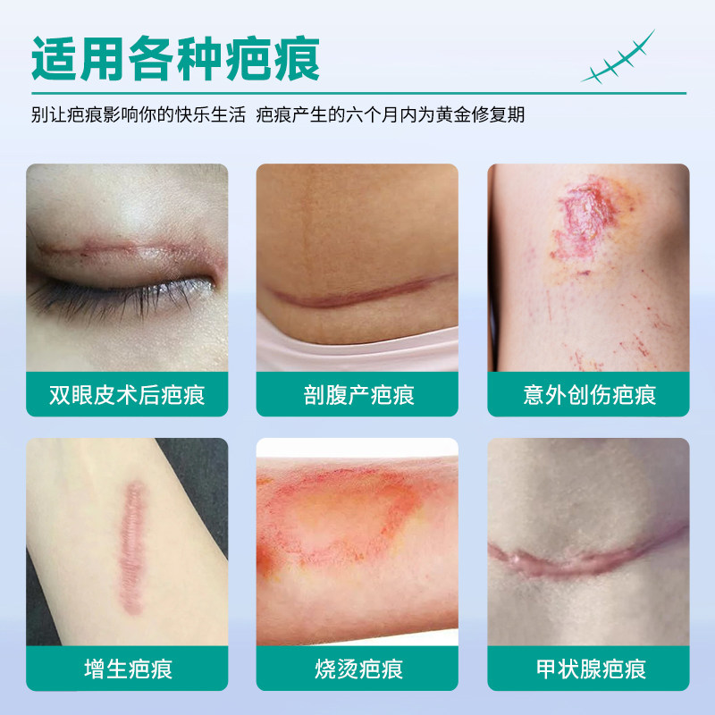 仁和疤痕贴医用硅凝胶祛疤手术烫伤剖腹产烧伤增生护理隐形产品,淘宝优惠券,粉丝福利购,淘宝优惠卷