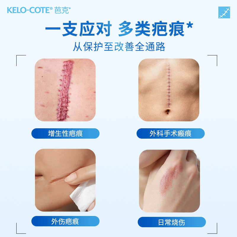 芭克祛疤膏疤克去疤痕修复巴克除疤膏官方旗舰店正品医用凝胶痘印
