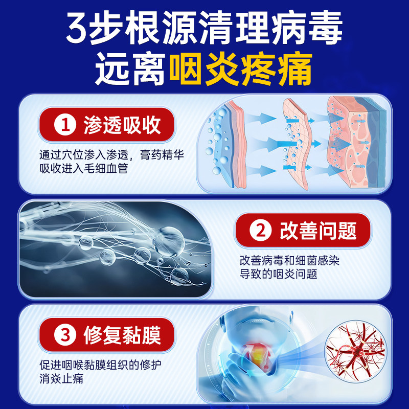 咽喉炎慢性咽炎根喉咙有痰异物感治疗咳嗽痒化痰止咳贴,淘宝优惠券,粉丝福利购,淘宝优惠卷