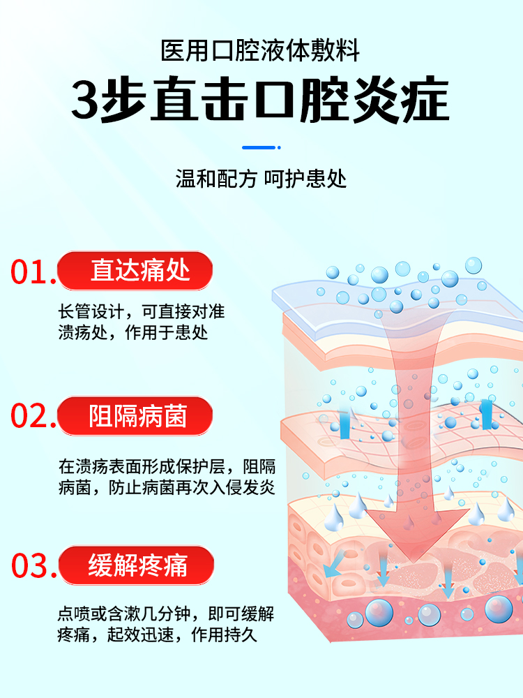 口腔溃疡喷剂嘴巴上火起泡烂舌头烂口腔内壁起泡喷雾非凝胶贴专用 - 图1