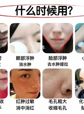 韩国美蒂菲美容院专用冷敷仪 缓解泛红收缩毛孔V脸促进吸收小冰锤