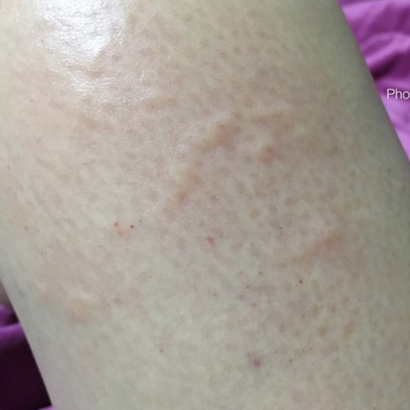 韩国直邮代购一洋紫外线过敏痱子软膏烧伤皮肤湿 疹膏 - 图0