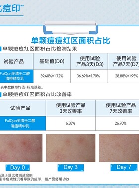 芙清20%壬二酸清痘精华乳水杨酸15g祛痘淡化痘印痘痘粉刺闭口