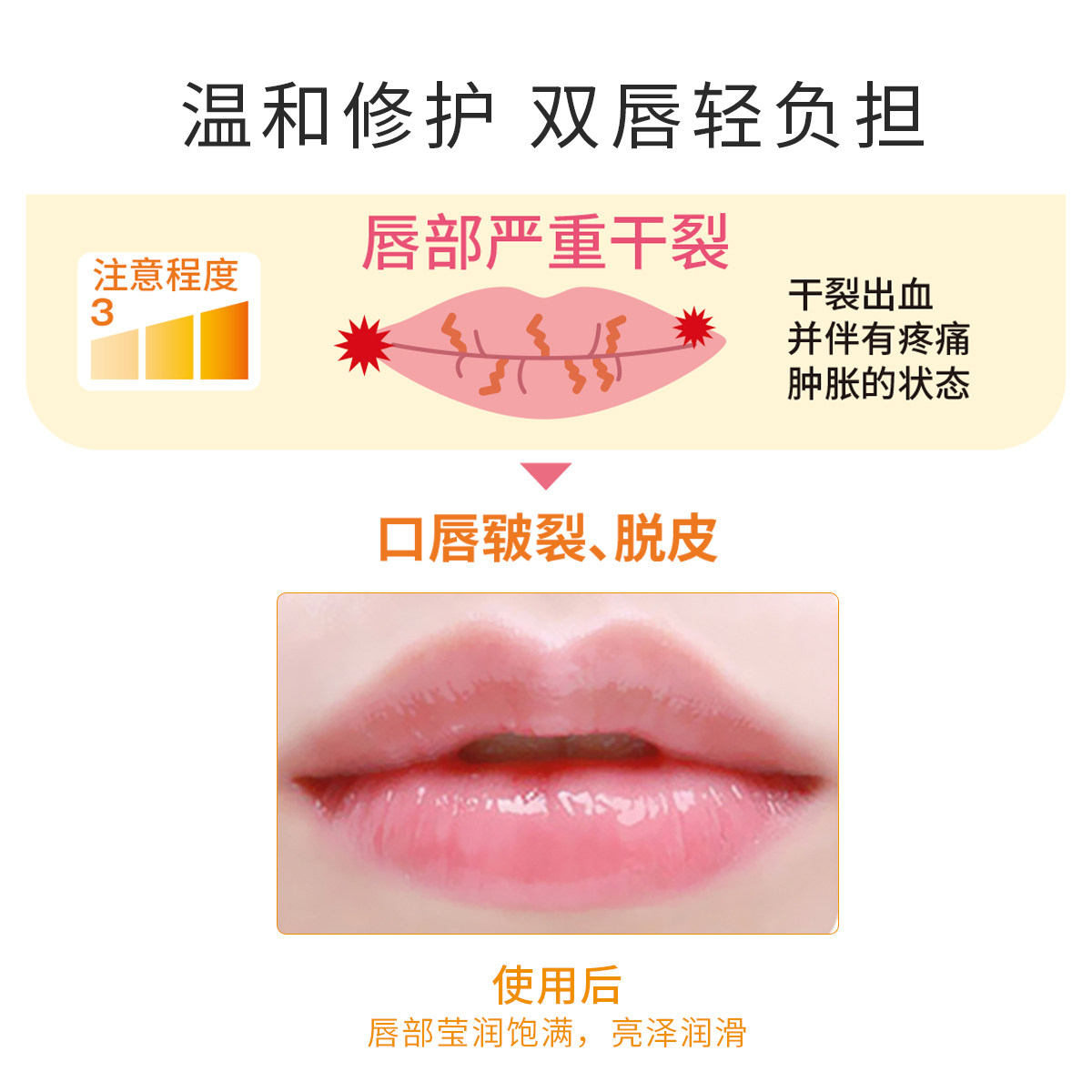 日本yuskin悠斯晶维生素修护润唇膏 yuskin悠斯晶化妆品润唇膏