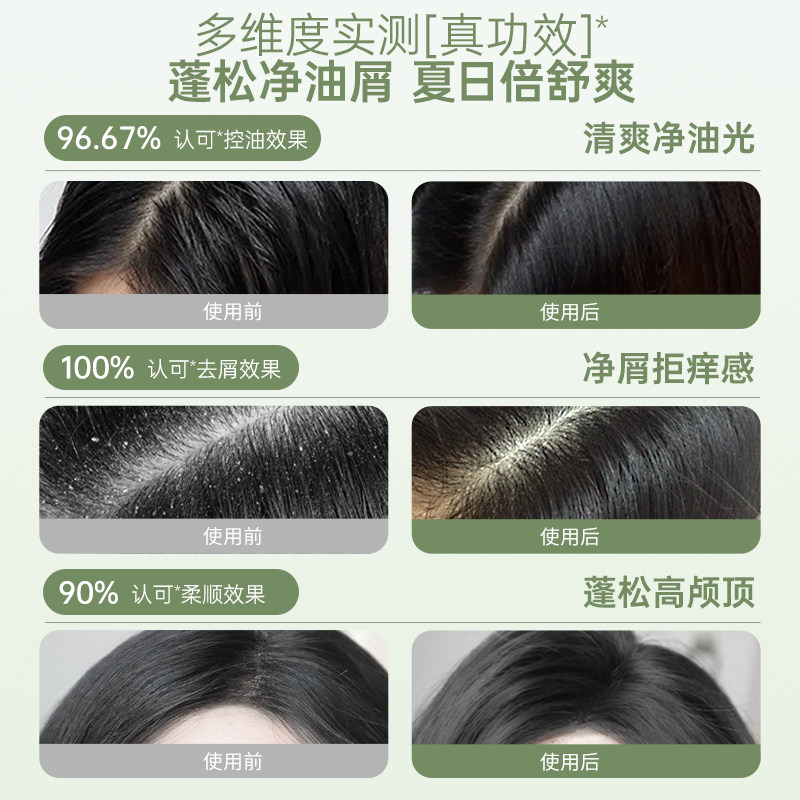 袋鼠妈妈青少年洗发水护发素儿童专用去屑控油男女孩学生旅行装,淘宝优惠券,粉丝福利购,淘宝优惠卷