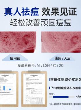 仁和匠心祛痘点涂精华液官方正品