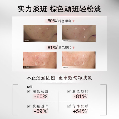 【88VIP专属】修丽可淡斑发光瓶 烟酰胺淡斑淡痘印提亮祛斑 - 图3