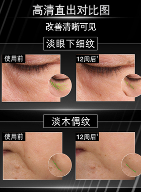 修丽可抗皱精华淡鱼尾纹法令纹