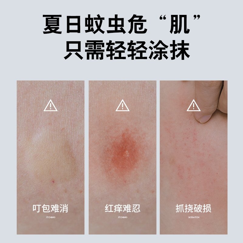 紫草膏婴儿防护专用蚊虫叮咬止痒药膏儿童宝宝舒缓草本清凉驱蚊膏,淘宝优惠券,粉丝福利购,淘宝优惠卷