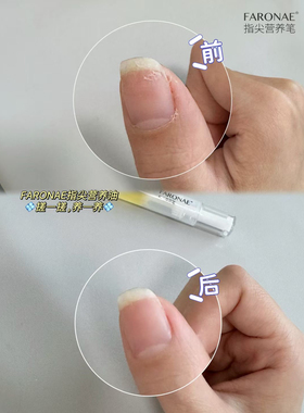 法朗妮指尖营养油清洁笔穿戴甲指甲修护改善倒刺细纹死皮精油养护