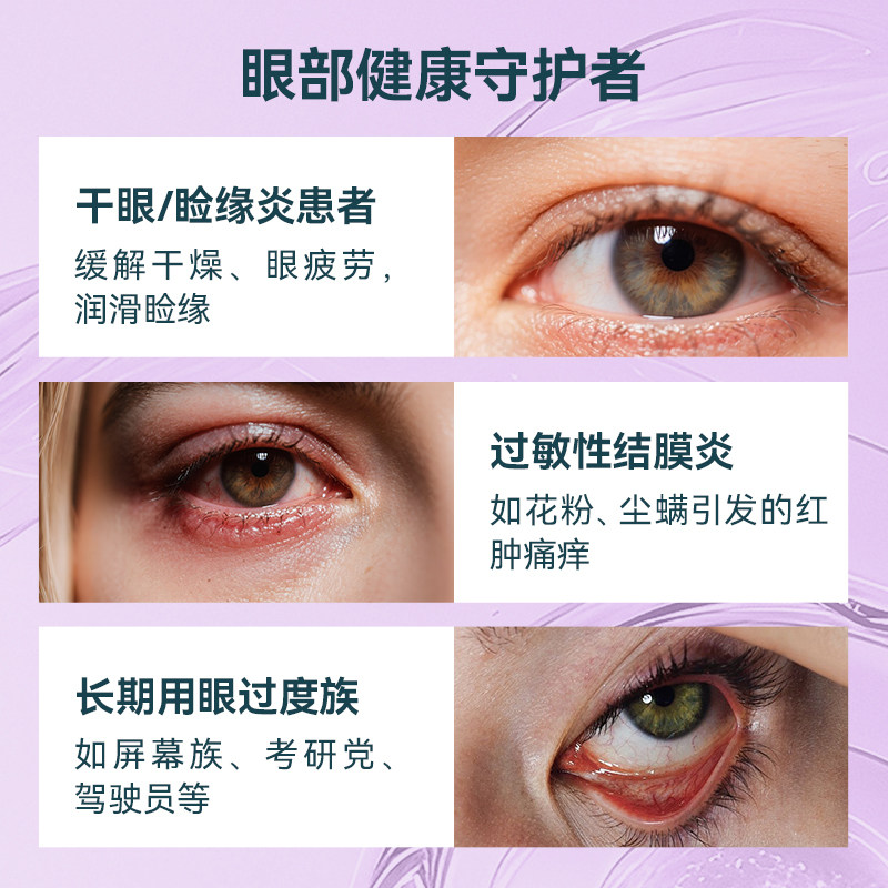 Densmore抗花粉过敏结膜炎角膜炎消炎眼药水沙眼睛止痒去红滴眼液,淘宝优惠券,粉丝福利购,淘宝优惠卷