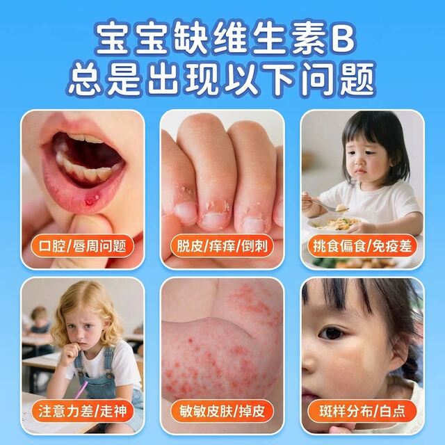 ປາກເປື່ອຍພັດທະນາຊ້າໆ
