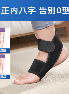 儿童内外八矫正器XO腿型纠正绑带