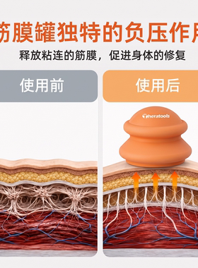 theratools筋膜罐硅胶易软罐刮痧
