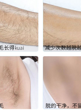 正彩脱毛膏批发学生去腋下手毛腿毛脱毛膏喷雾慕斯男女士夏季