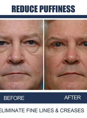 Men Eye Cream Eye Cream Reduces Appearance Of Fine Lines Ret