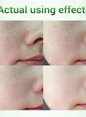 Salicylic Acid Pore Shrinking Cream Quick Remove Blackehead