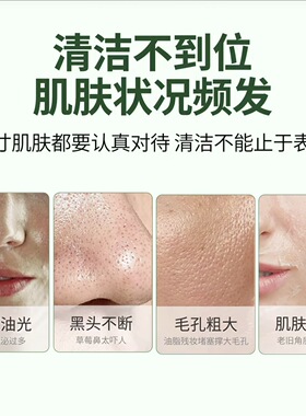 荷兰Aizoon绿泥面膜150g保湿清洁