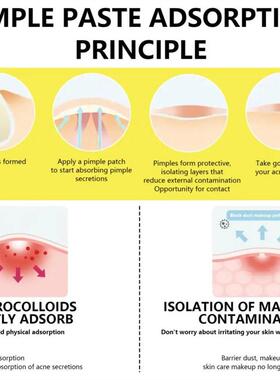 Hydrocolloid Face Mask For Acne, 5 Large Pimple Patches For