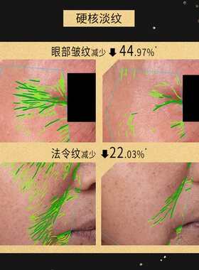 言之有物50%玻色因精华霜面霜