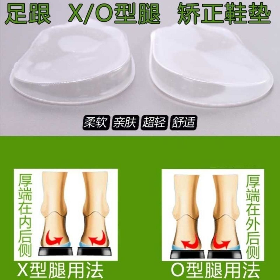 矫正器膜炎脚跟脚垫歪偏男女鞋垫半码o型翻成型腿xo罗圈腿宝宝 - 图3