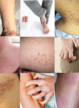 苗瑞堂藏药宝典全身私处大腿内侧身上小腿屁股肛门皮肤干燥外用膏