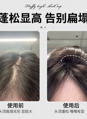发根蓬松夹高颅顶神器定