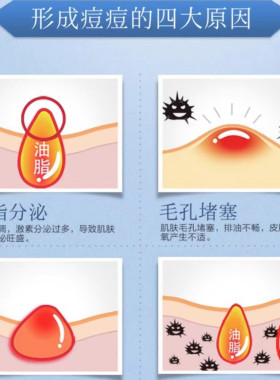 首博尔清痘凝胶正品带防伪